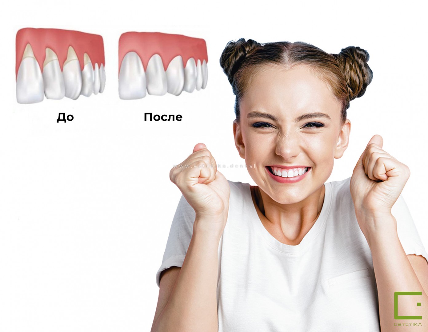 лечение дёсен одесса